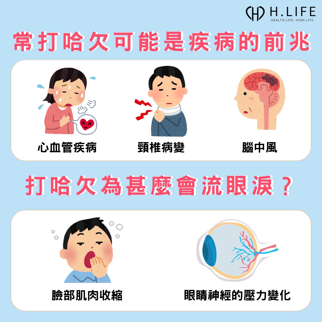 常打哈欠可能是疾病的前兆，打哈欠為什麼會流眼淚？