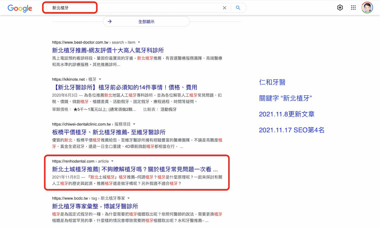 仁和牙醫 關鍵字 “新北植牙” SEO第4名